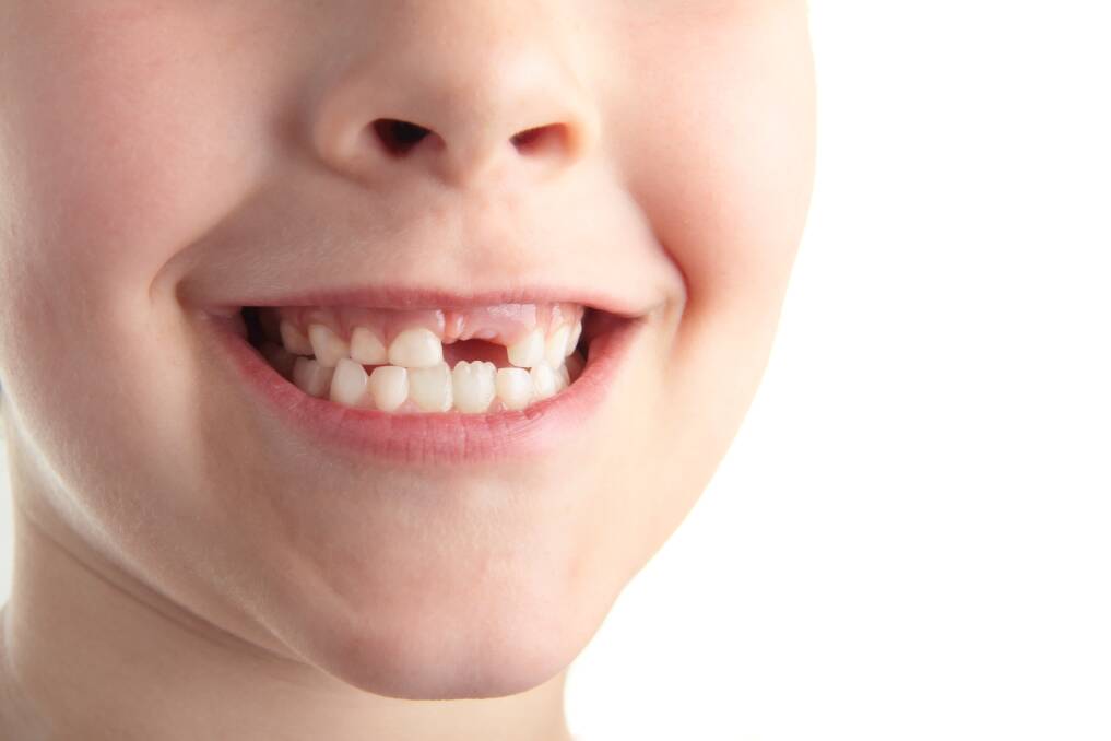 Why do we have two different sets of teeth?